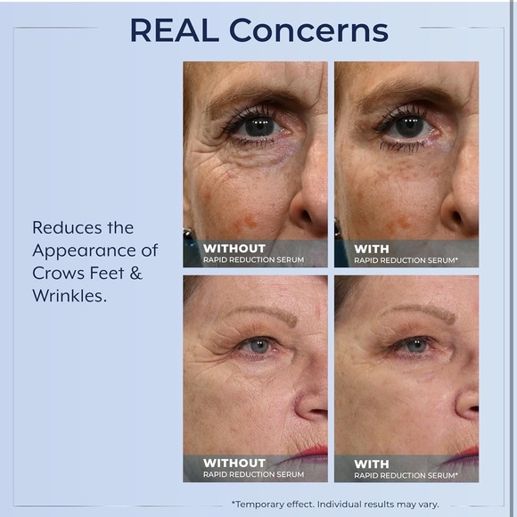 2 Plexaderm Rapid Reduction Advanced Serum AS SEEN ON TV's Best Selling Skincare - Picture 12 of 15